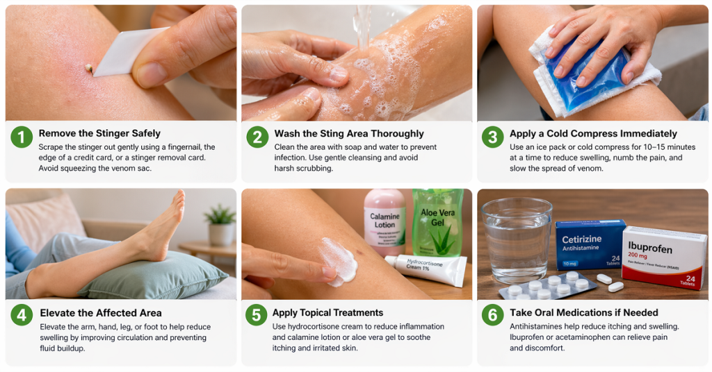 Step-by-Step Bee Sting First Aid at Home